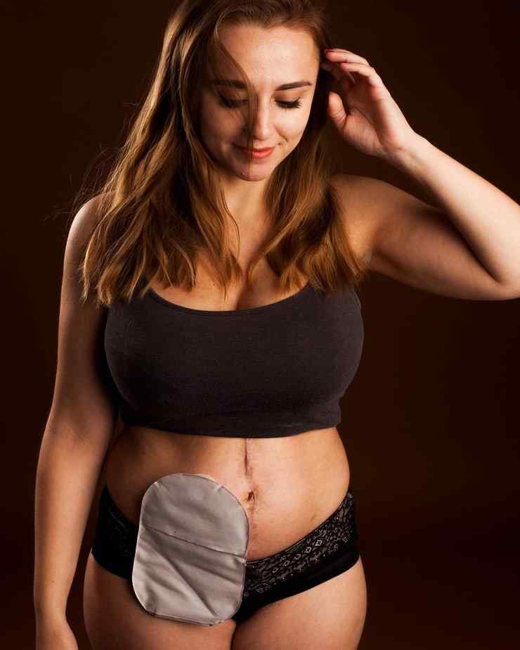 55+ Hot Pictures Of Hannah Witton Which Will Make You Fantasize Her | Best Of Comic Books