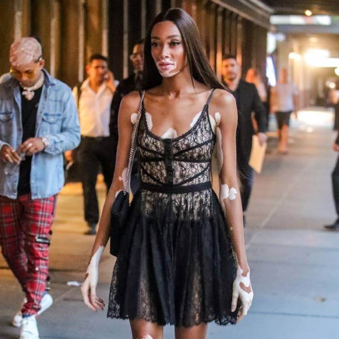 49 Hot Pictures Of Winnie Harlow Which Are Going To Make You Want Her Badly | Best Of Comic Books